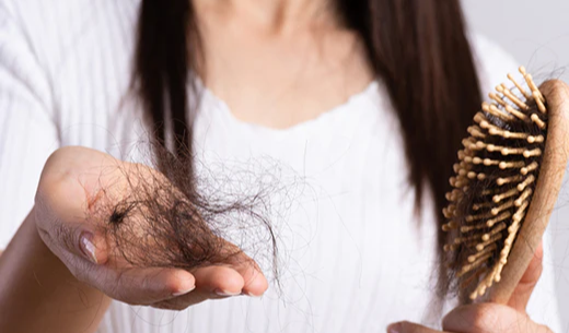 Why Hair Fall Increases in Winter : శీతాకాలంలో జుట్టు రాలడం కారణాలు– నిపుణుల సూచనలు